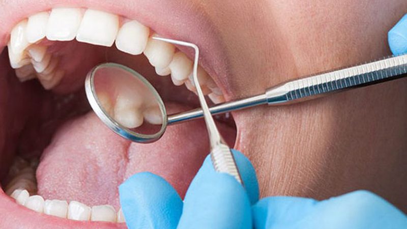 Periodoncia en Clínica Goleta, Playa de San Juan